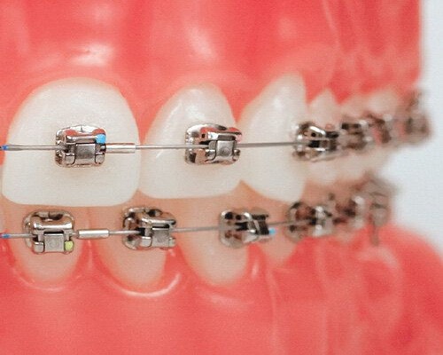 ORTHODONTICS