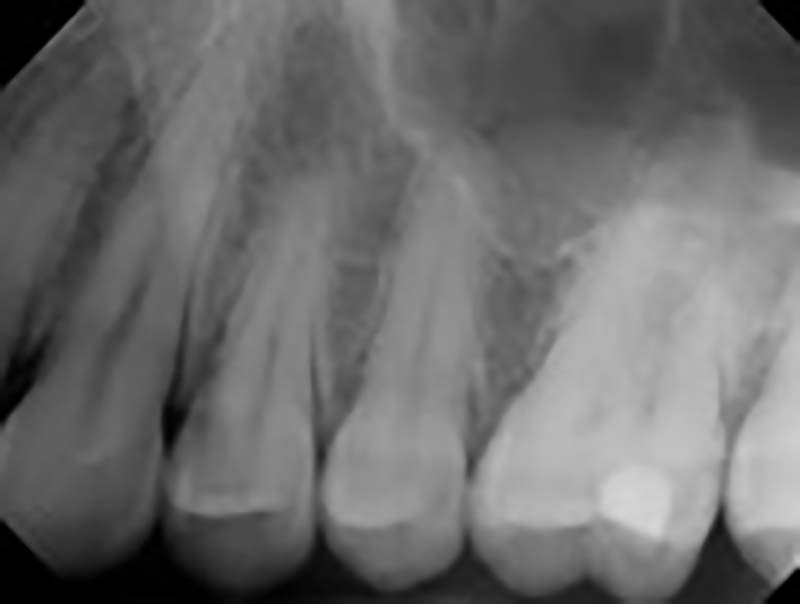 ORAL MEDICINE AND RADIOLOGY