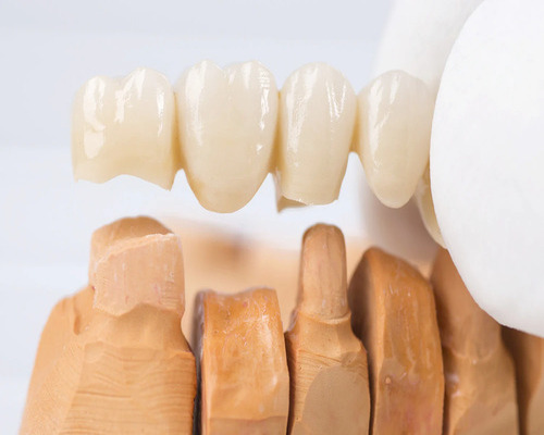 PROSTHODONTICS