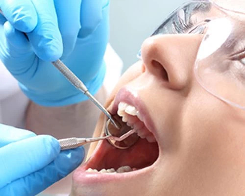 PREVENTIVE DENTISTRY