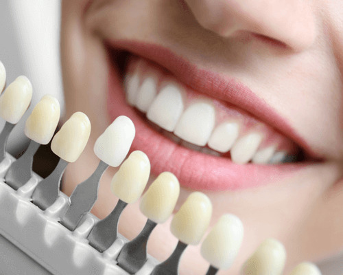 COSMETIC DENTISTRY